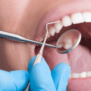 dental-exam