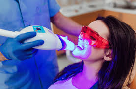 whiteteeth